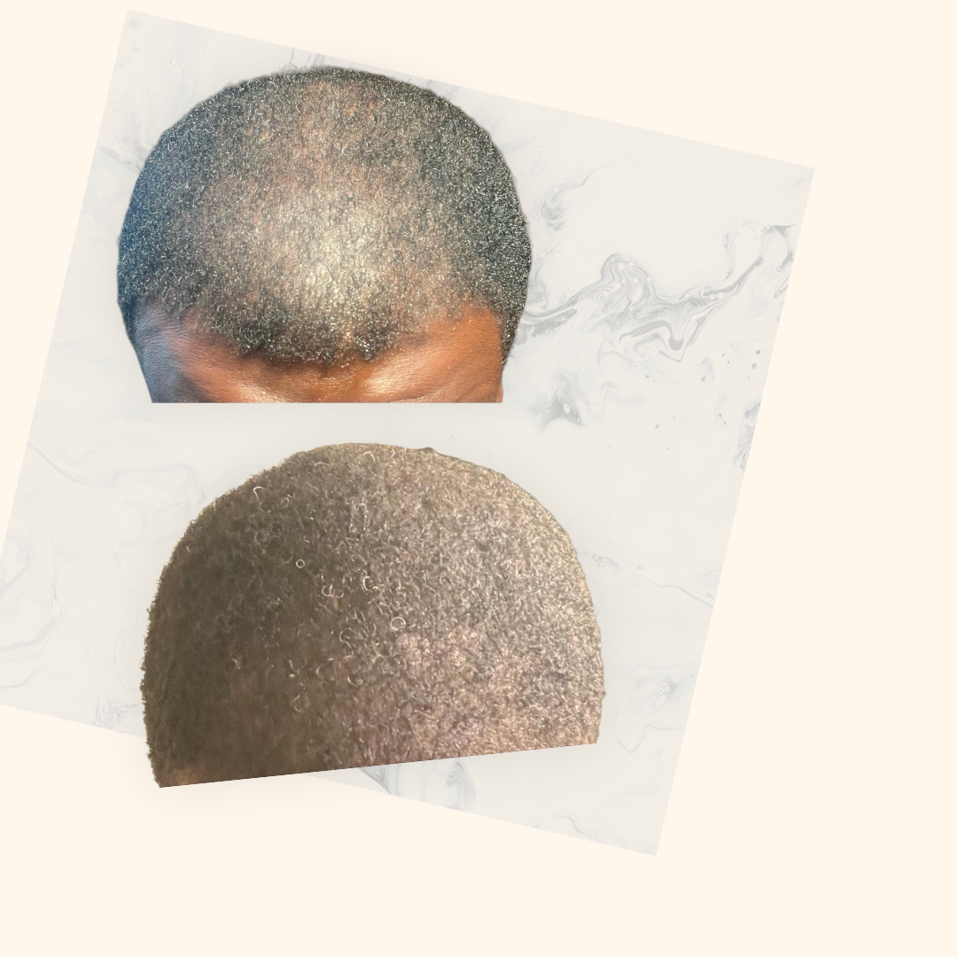 Customer's crown before starting the routine, with visible thinning