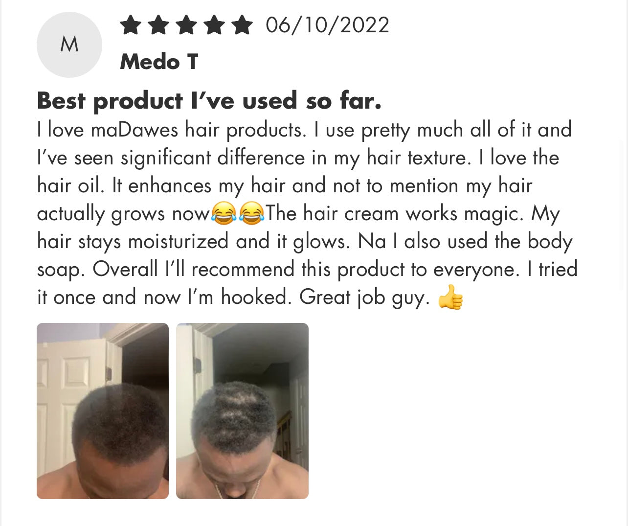 Edge Revival Starter Kit - 30 Days to Healthier Edges”