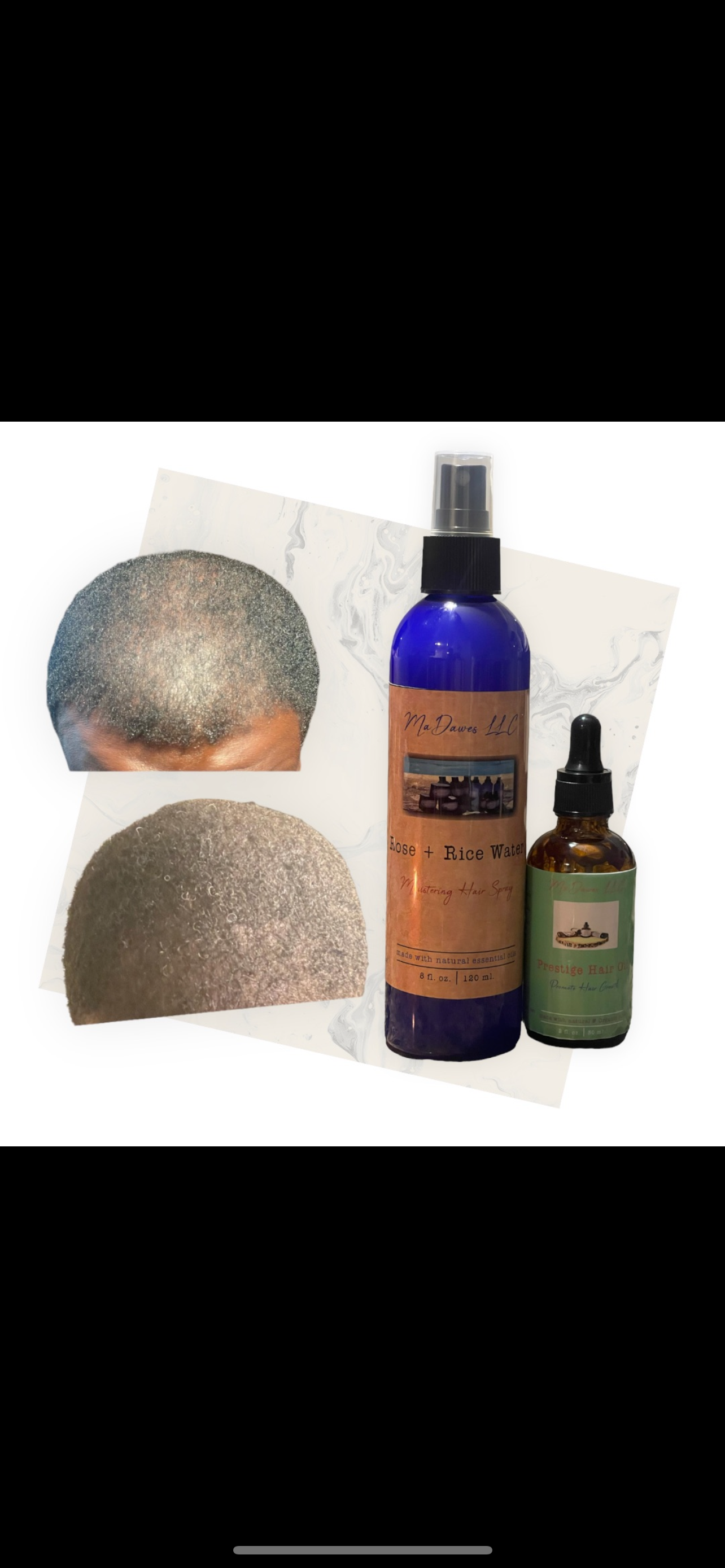 Bundle 1: Edge Revival Hair Bundle - $49 (compare-at $79.95) Save $30.95