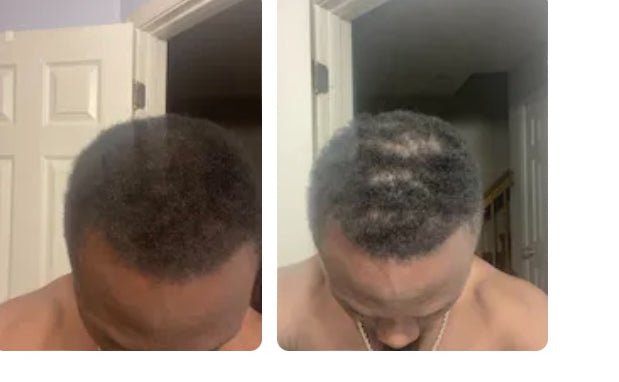 Edge Revival Starter Kit - 30 Days to Healthier Edges”